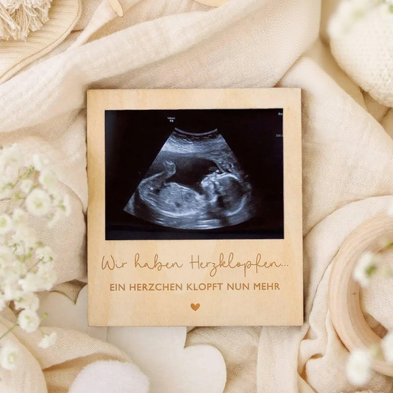Ultrasound Pregnancy Announcem - Photo Frame Baby ulasan dan harga